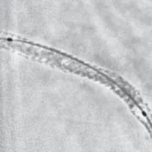 Stent view